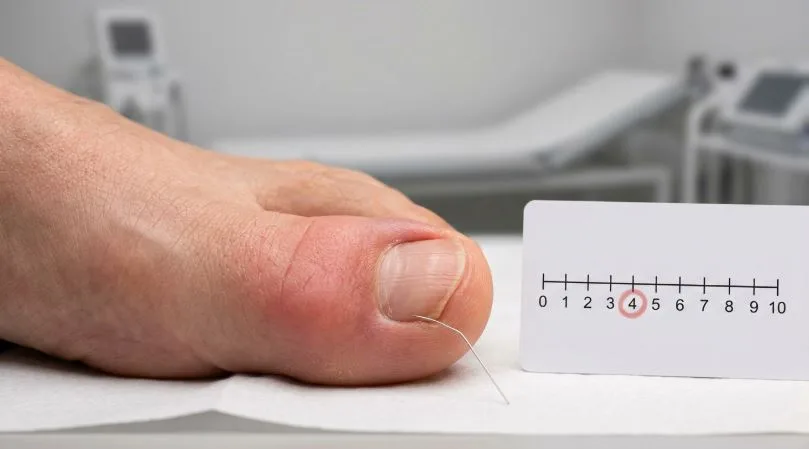  Какие симптомы требуют внепланового визита к подологу